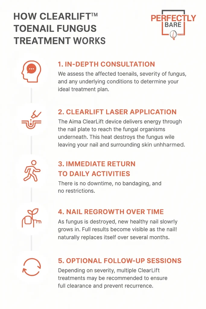 ClearLift Toenail Fungus Treatment in Tampa : 5 steps including consultation, laser application, immediate activity return, nail regrowth, and follow-ups.