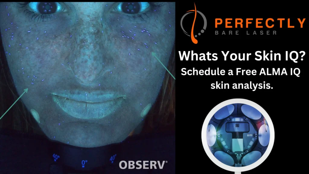 ALMA IQ a cutting edge skin assessment tool