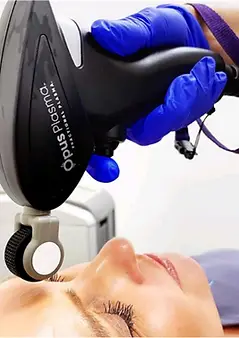 Laser Training Program 4 ALMA OPUS