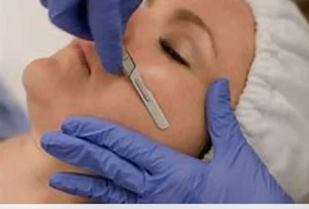 Dermaplaning