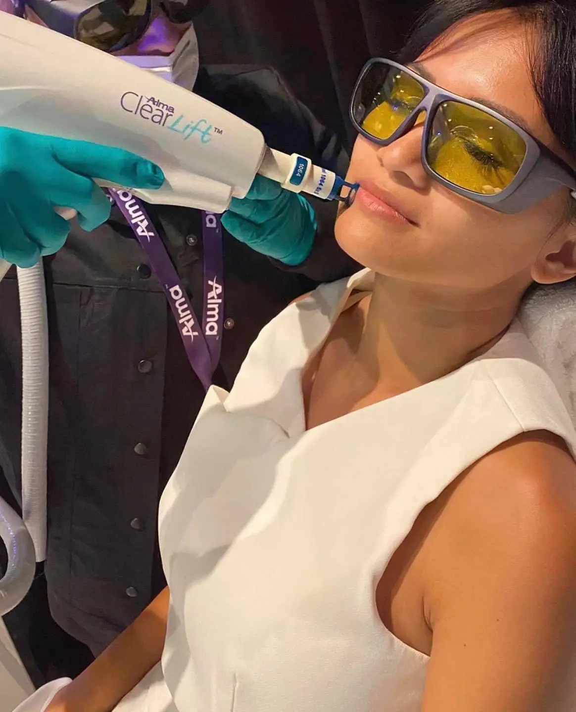 Home 68 Our Alma Laser Harmony ClearLift treatment