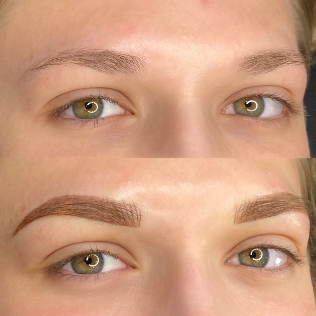 Permanent Makeup 2 Perfectly Bare Laser