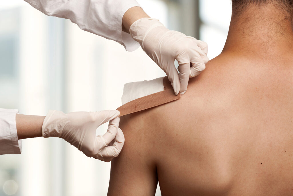 Scars or injuries on your area that you want to laser?