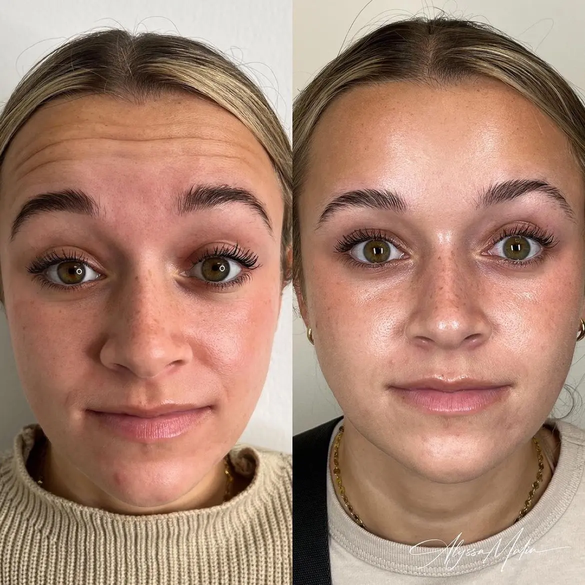 Home 72 Wellness and hormone optimization therapy at Tampa MedSpa